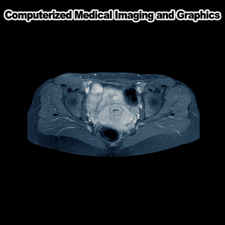 Opportunistic AI for enhanced cardiovascular disease risk stratification using abdominal CT scans