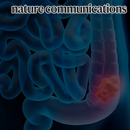 Protein stabilization of ITF2 by NF-κB prevents colitis-associated cancer development