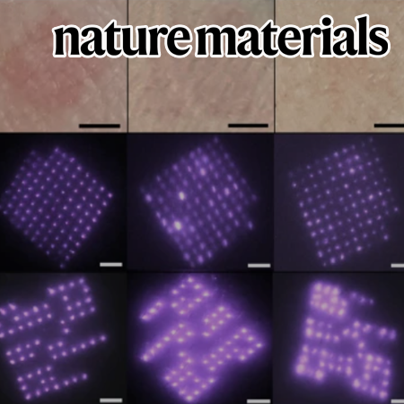 On-patient medical record and mRNA therapeutics using intradermal microneedles