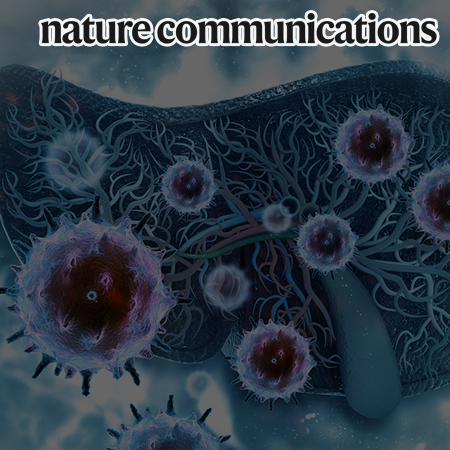 Palmitic acid aggravates liver cancer progression