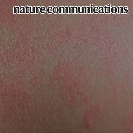 Homeostatic serum IgE is secreted by plasma cells in the thymus and enhances mast cell survival
