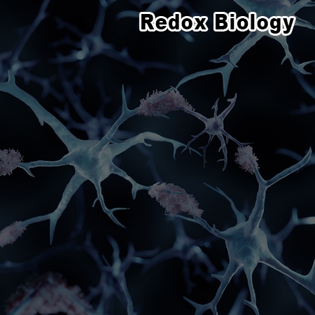 Glucocorticoid enhances presenilin1-dependent Aβ production at ER's mitochondrial-associated membrane by downregulating Rer1 in neuronal cells