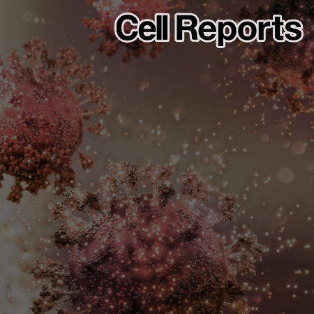 Super-resolution proximity labeling reveals antiviral protein network and its structural changes against SARS-CoV-2 viral proteins