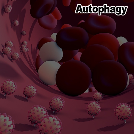 TRIM16-mediated lysophagy suppresses high-glucose-accumulated neuronal Aβ